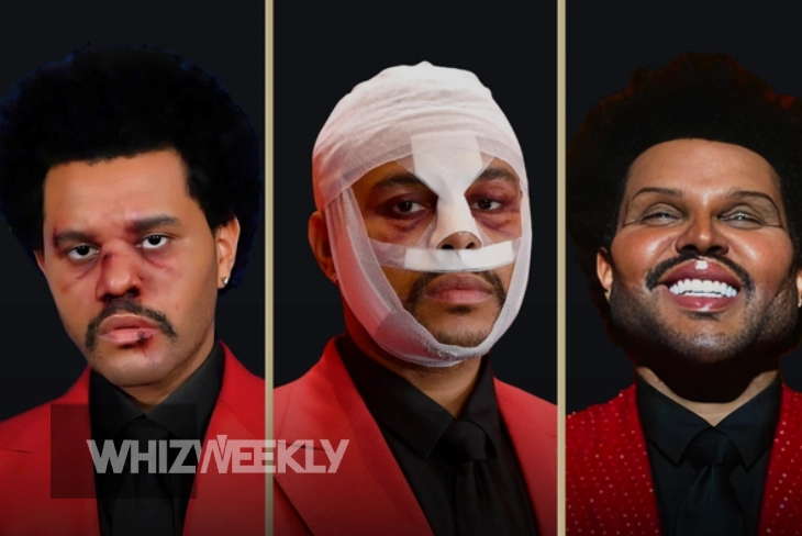 The Weeknd Plastic Surgery: Fans React to His Changing Appearance