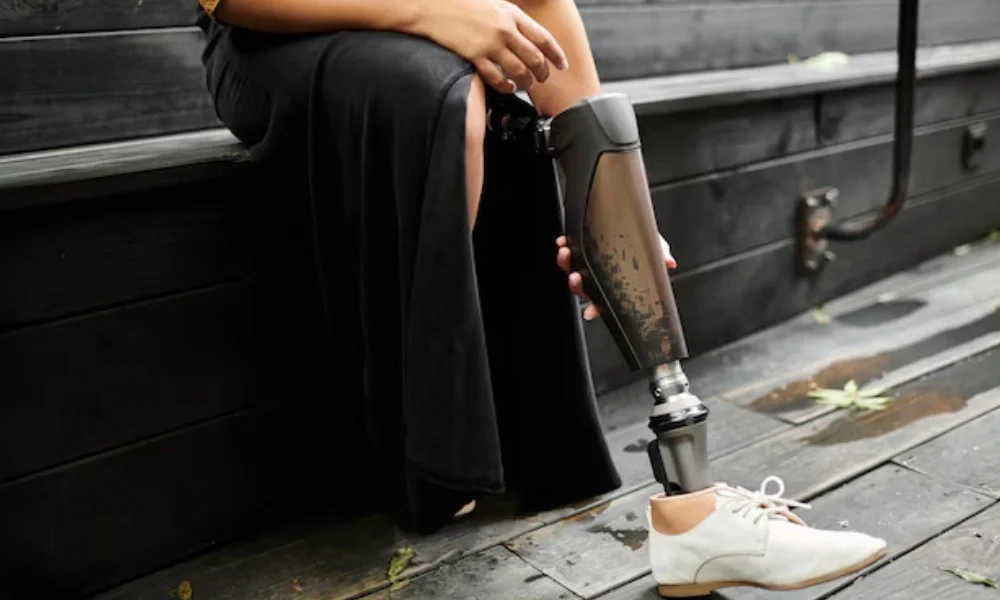 Did Barabar Kingston amputate her leg? Investigating the viral amputation rumor and its origins.