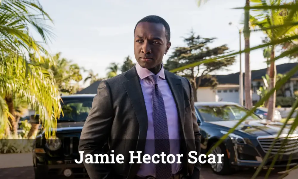 Jamie Hector Scar: The Shocking Truth Behind His Mysterious Mark Jamie Hector Scar – The actor’s defining facial feature and its impact on his Hollywood career in The Wire and Bosch.