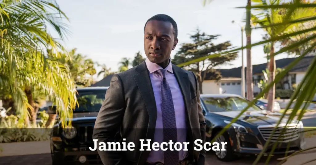 Jamie Hector Scar – The actor’s defining facial feature and its impact on his Hollywood career in The Wire and Bosch.