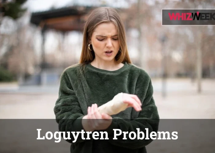 Hand with Loguytren Problems showing finger contracture and palmar cords